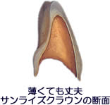 サンライズ(金箔)1 サンライズ(金箔)1